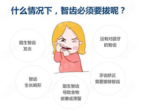 拔智齿的不同情况 拔智齿的不同情况