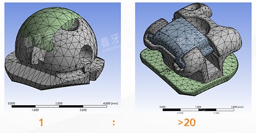 牙齿矫正OBrace球面托槽对比方形托槽 牙齿矫正OBrace球面托槽对比方形托槽