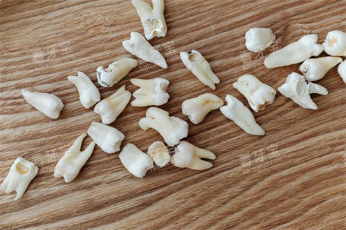 牙齿制作过程图片 牙齿制作过程图片