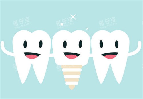 种植牙和健康牙齿图 种植牙和健康牙齿图