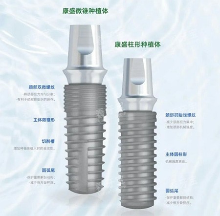 康盛微锥种植牙 康盛微锥种植牙