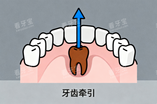 ����ǣ����ͨͼ