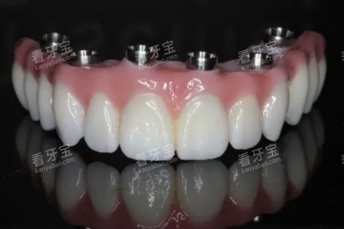 all-on-6��ֲͼƬչʾ