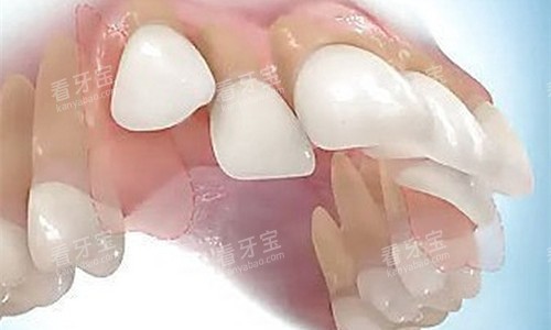 ����ͻأ��ͨͼ