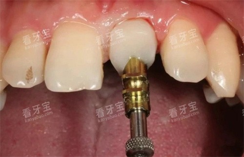 ǰ����ѧ�޸�ʵ��