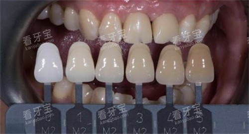 ǰ����ѧ�޸�