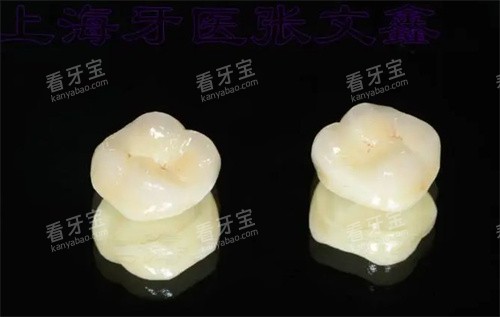 爱尔创全瓷牙外观 爱尔创全瓷牙外观