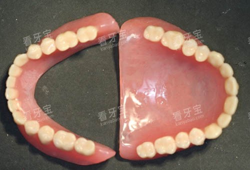 全口假牙照片 全口假牙照片