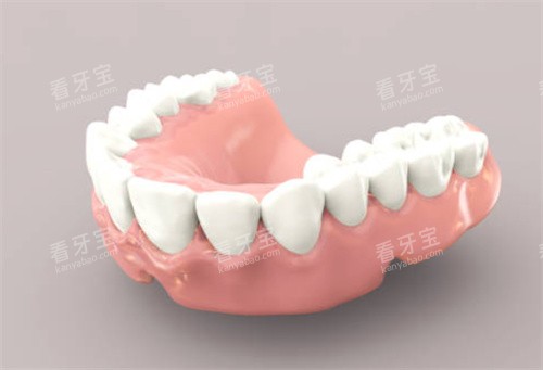 假牙模型图 假牙模型图