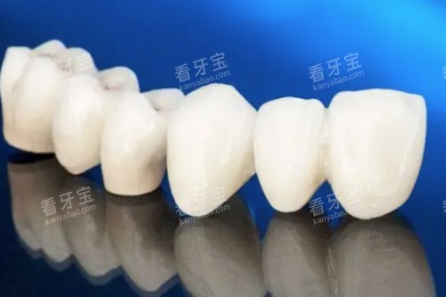 爱尔创全瓷牙模型图 爱尔创全瓷牙模型图