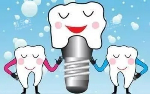 牙齿种植体示意图 牙齿种植体示意图