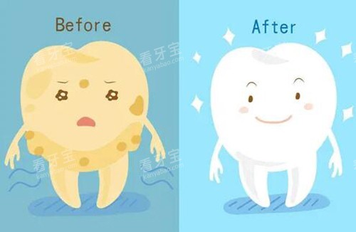 牙齿美白改善图卡通 牙齿美白改善图卡通