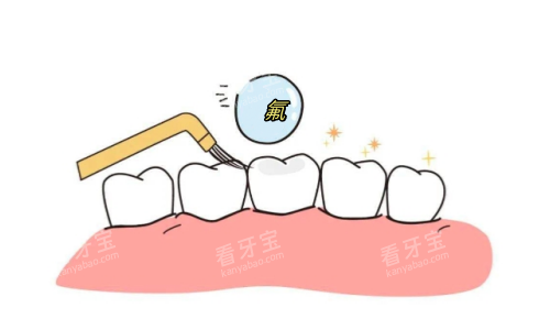 儿童牙齿涂氟动画展示图 儿童牙齿涂氟动画展示图