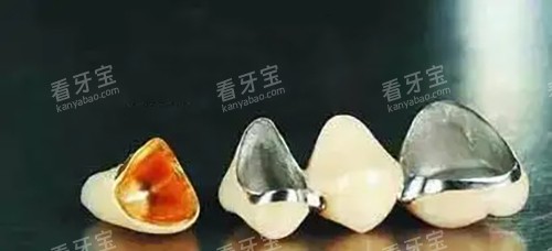 烤瓷牙冠实物示意图 烤瓷牙冠实物示意图