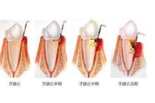 �����׵ķ�չ����