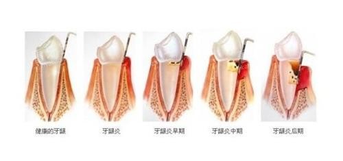 �����׵ķ�չ����