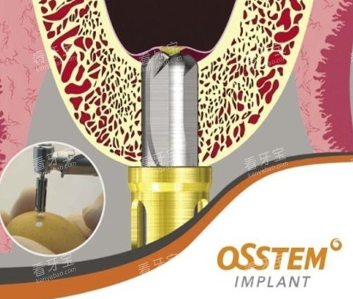 �³�̩��ֲ�����Ϻò���