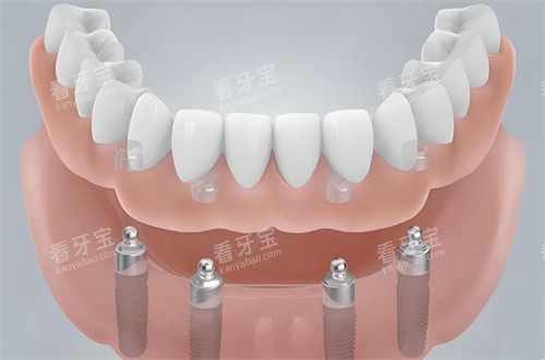 �����ֲ��ģ��ͼչʾ