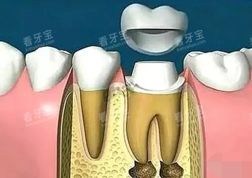 �������ƺ������