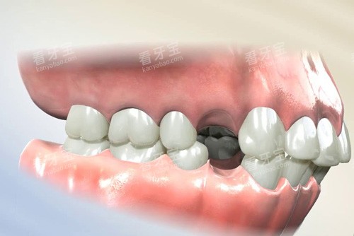 �����������ݽ���ʾ��ͼ