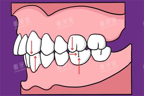 ���϶���ͼ