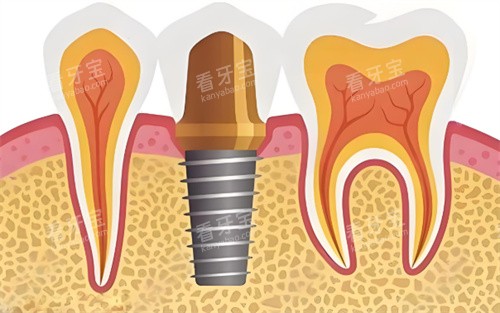 ��ֲ��չʾͼƬչʾͼ