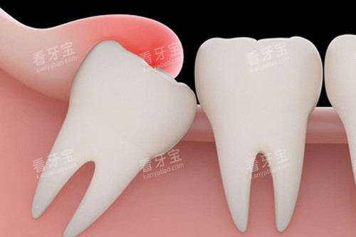 �ǳ�����ʾ��ͼ