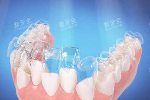 �������׽�������ʾ��ͼ