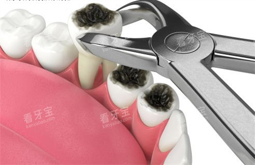 �����γ�