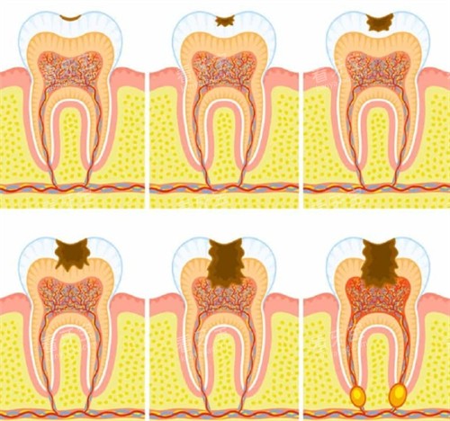 ��Ҫ�������Ƶ�����