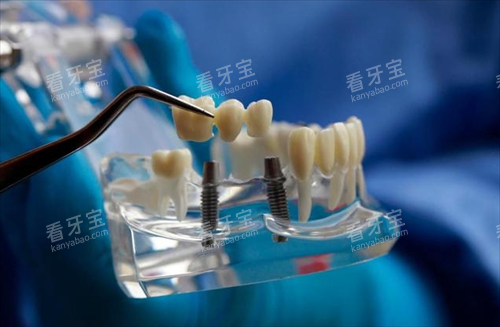 ��ֲ����Ƭ