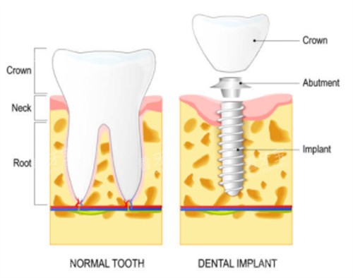 ��ֲ�����������ݶԱ�ͼ