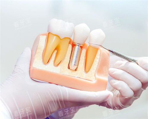 ������ֲ��ģ��