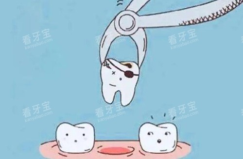 拔牙卡通图展示照片 拔牙卡通图展示照片