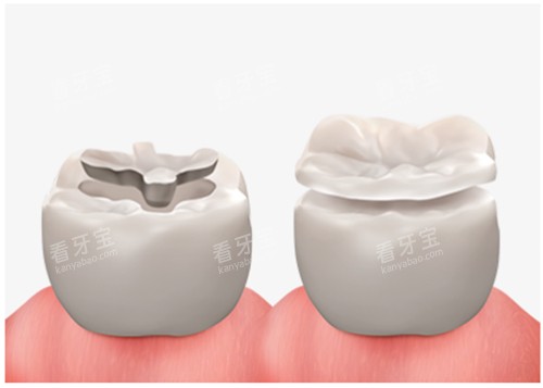 ��������ͼʾ