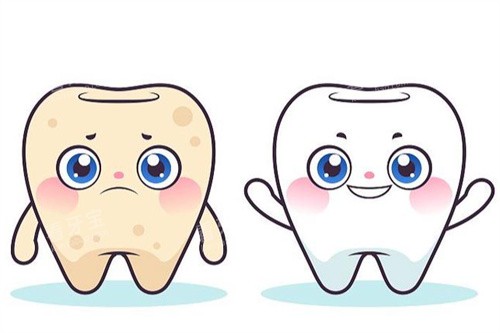 牙齿美白卡通前后对比 牙齿美白卡通前后对比