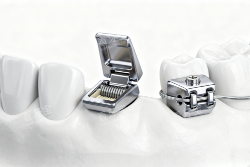 ��ͳ������������ͨչʾͼ