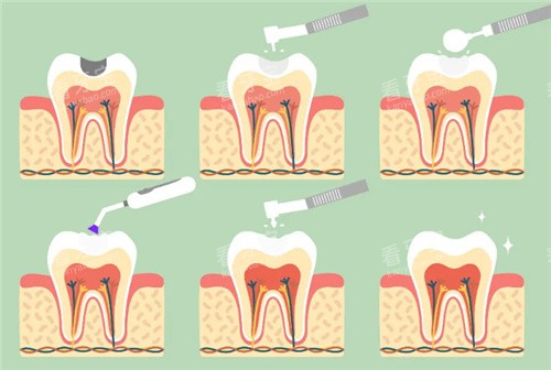 ��������ͼ