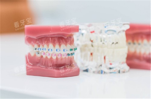 ����ģ��ͼʾ