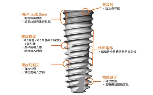 奥齿泰植体构造示意图 奥齿泰植体构造示意图