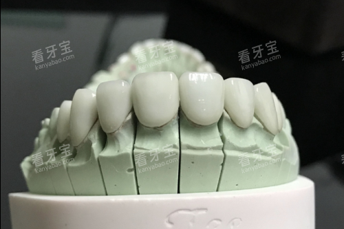 ȫ����ģ��չʾͼ