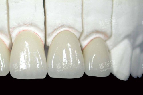 ȫ����ģ��ͼ