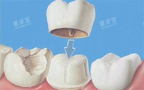 ȫ�����ڰ�װ