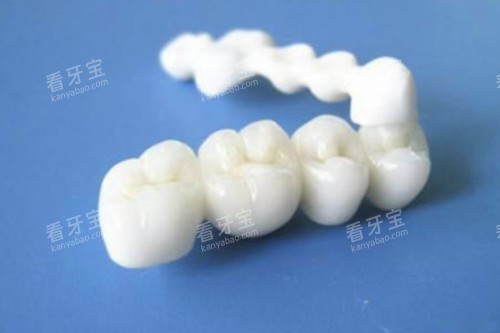 ȫ������ģ��һ��ͼ