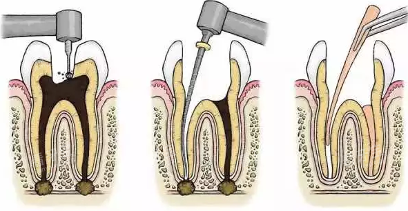 �������ƹ���