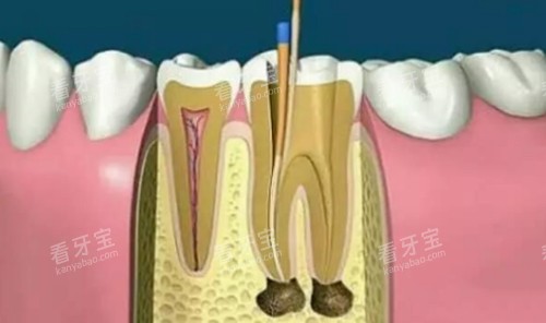 �������ƶ�����ʾ