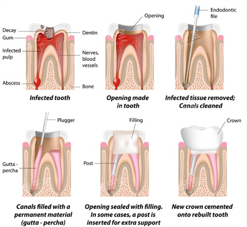 �������ƹ���ͼ