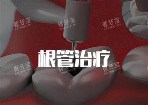 根管治疗卡通图 根管治疗卡通图