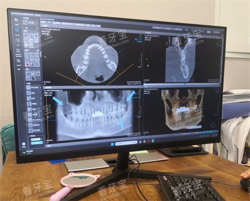 ������Ԫ�ؿ�ǻ������Ƭ��