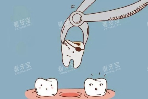 牙齿种植拔牙卡通示意图 牙齿种植拔牙卡通示意图